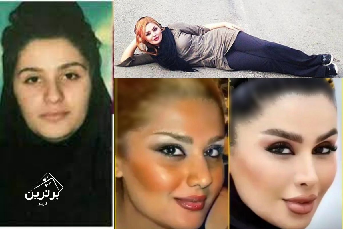 جراحی‌های زیبایی و تغییرات چهره